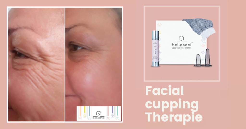 Facial cupping